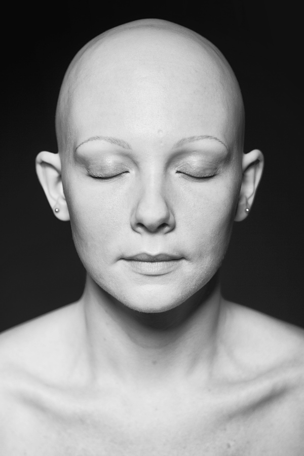 Daniel Regan The Alopecia Project