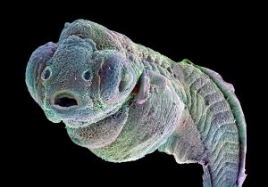 'Zebrafish embryo' by Annie Cavanagh / Wellcome Image Awards winner 2014 / Credit:Annie Cavanagh.CC BY-NC